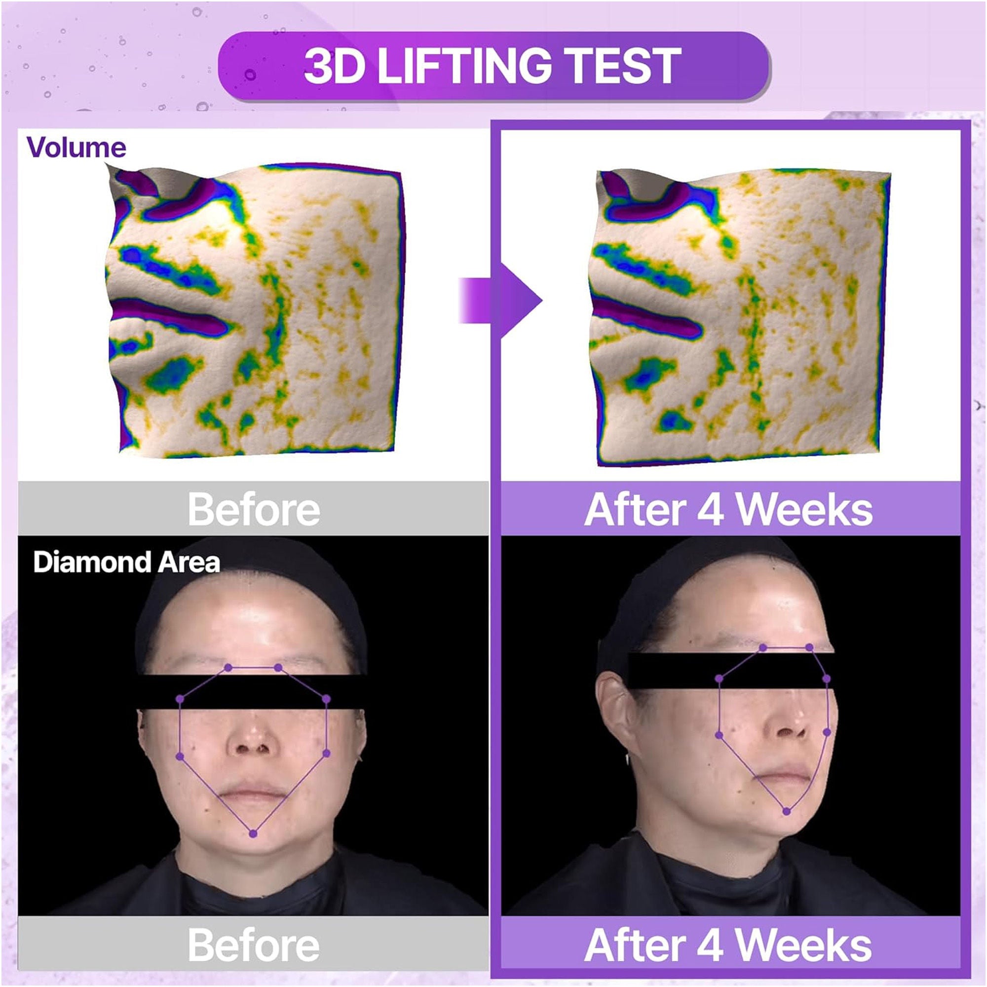 Probioderm 3D Lifting Ampoule - Firming Korean Serum Reduces Signs of Aging