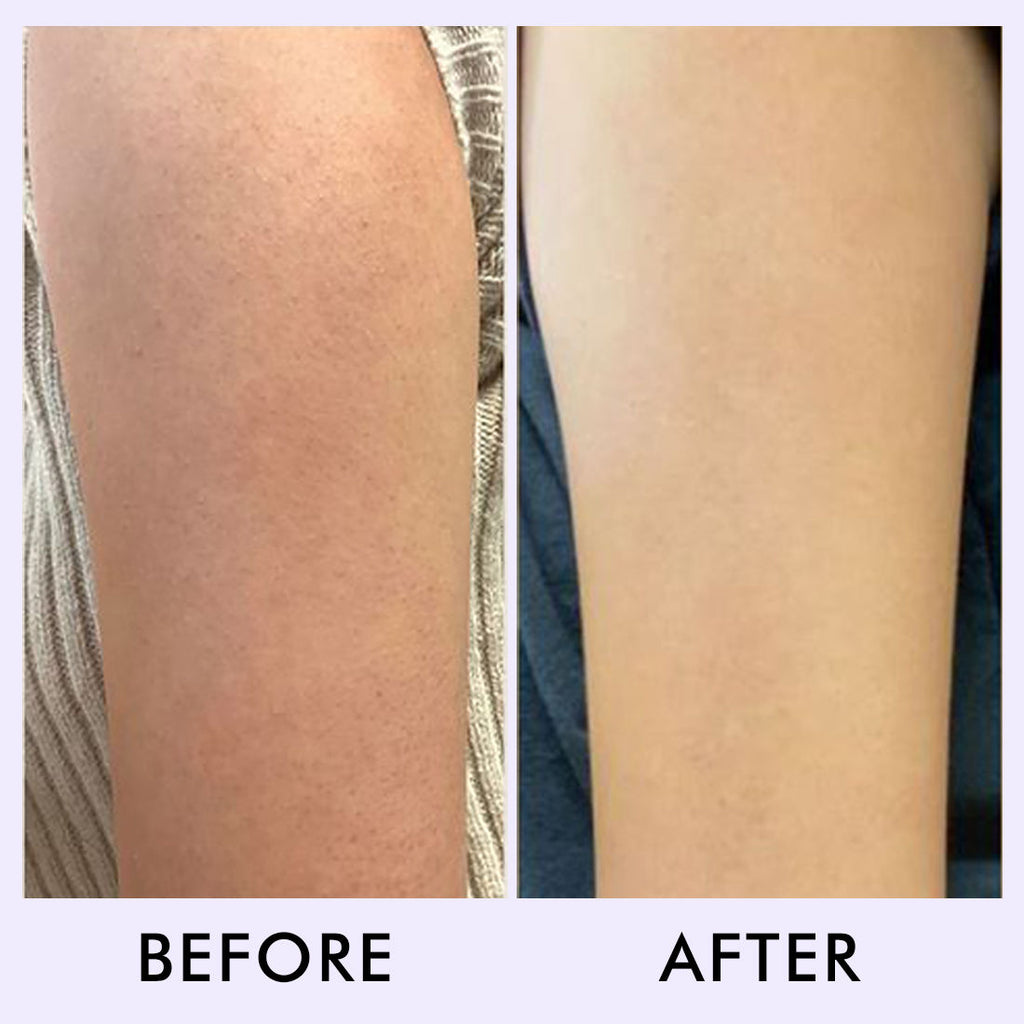Blueberry Breeze Body Scrub For Glowing Skin, Exfoliates & Removes Tan