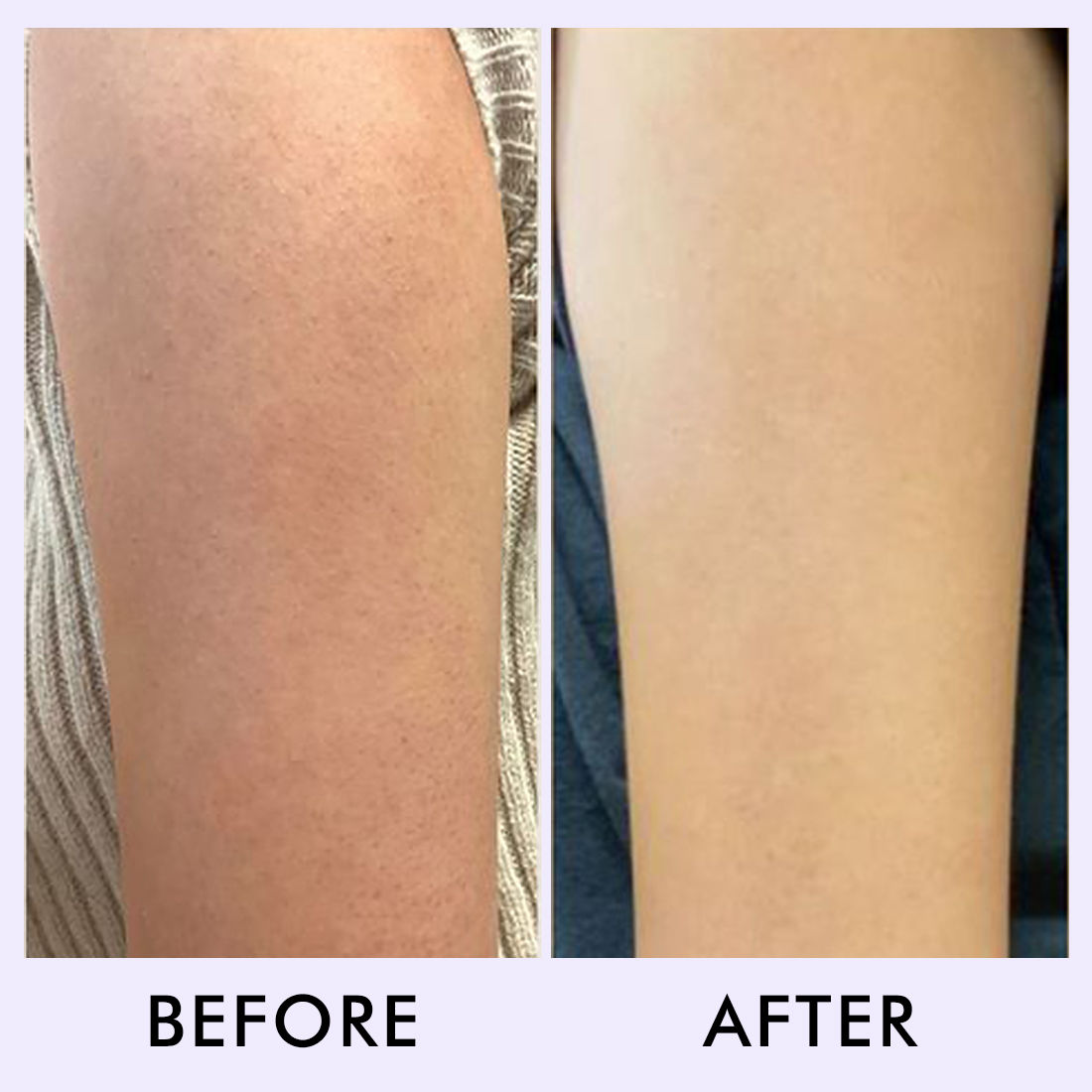 Blueberry Breeze Body Scrub For Glowing Skin, Exfoliates & Removes Tan