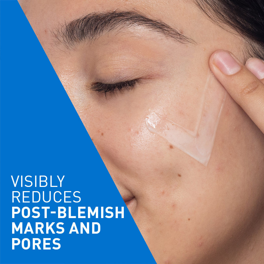 Resurfacing Retinol Serum, Reduces Acne Marks with Licorice Root Extract & Niacinamide