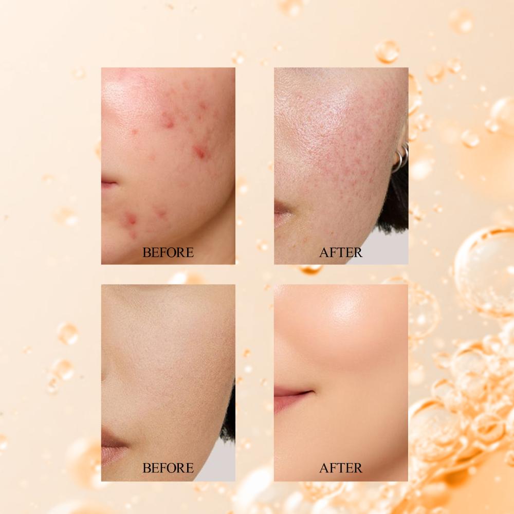 Vitamin C 10% + Niacinamide 2% Radiance Serum