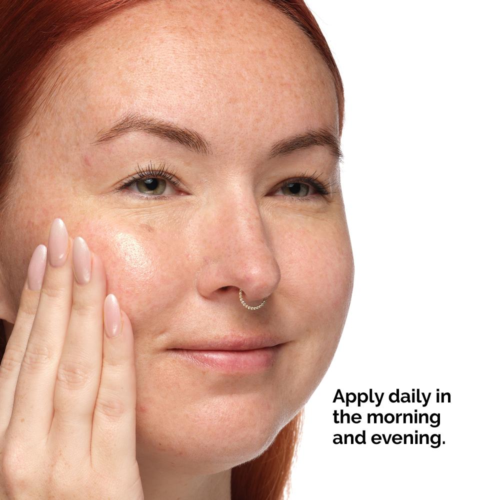 Marine Hyaluronics