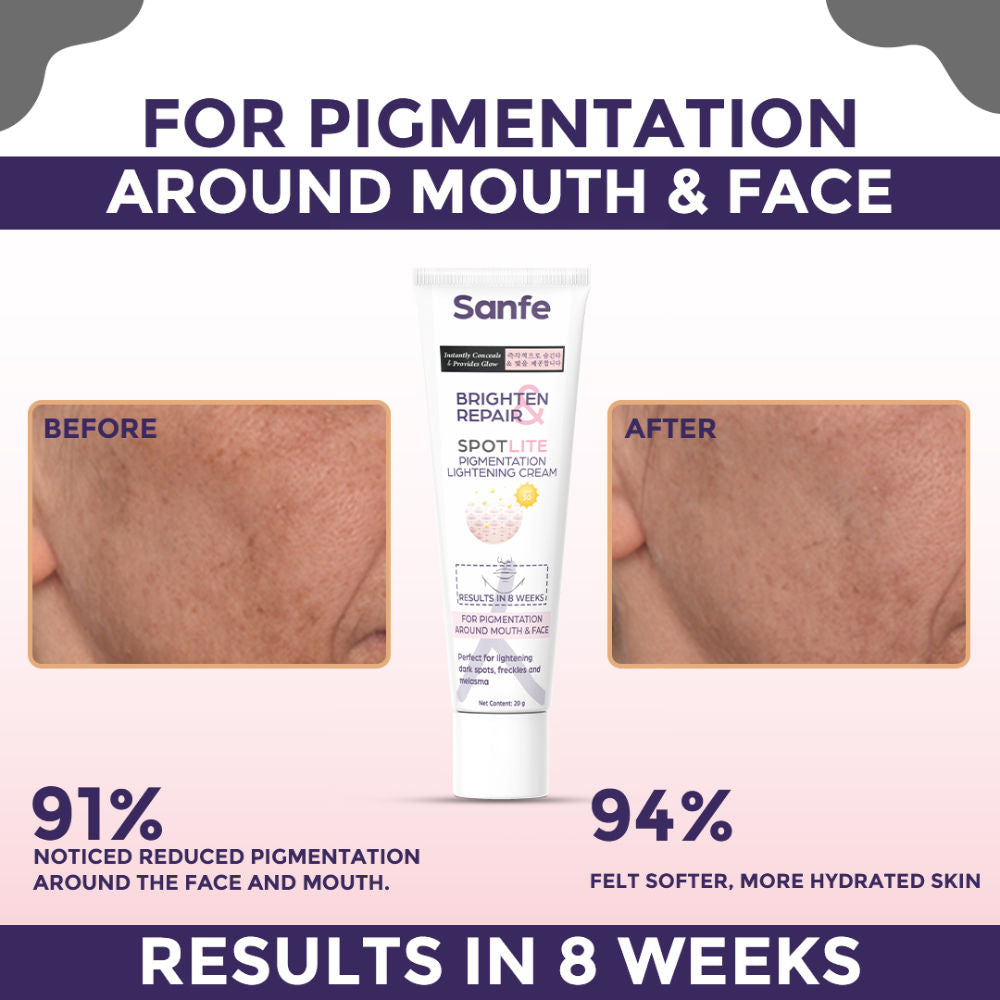 Pigmentation Lightening Cream, Kojic Acid, Glutathione, Dark Spots Removal