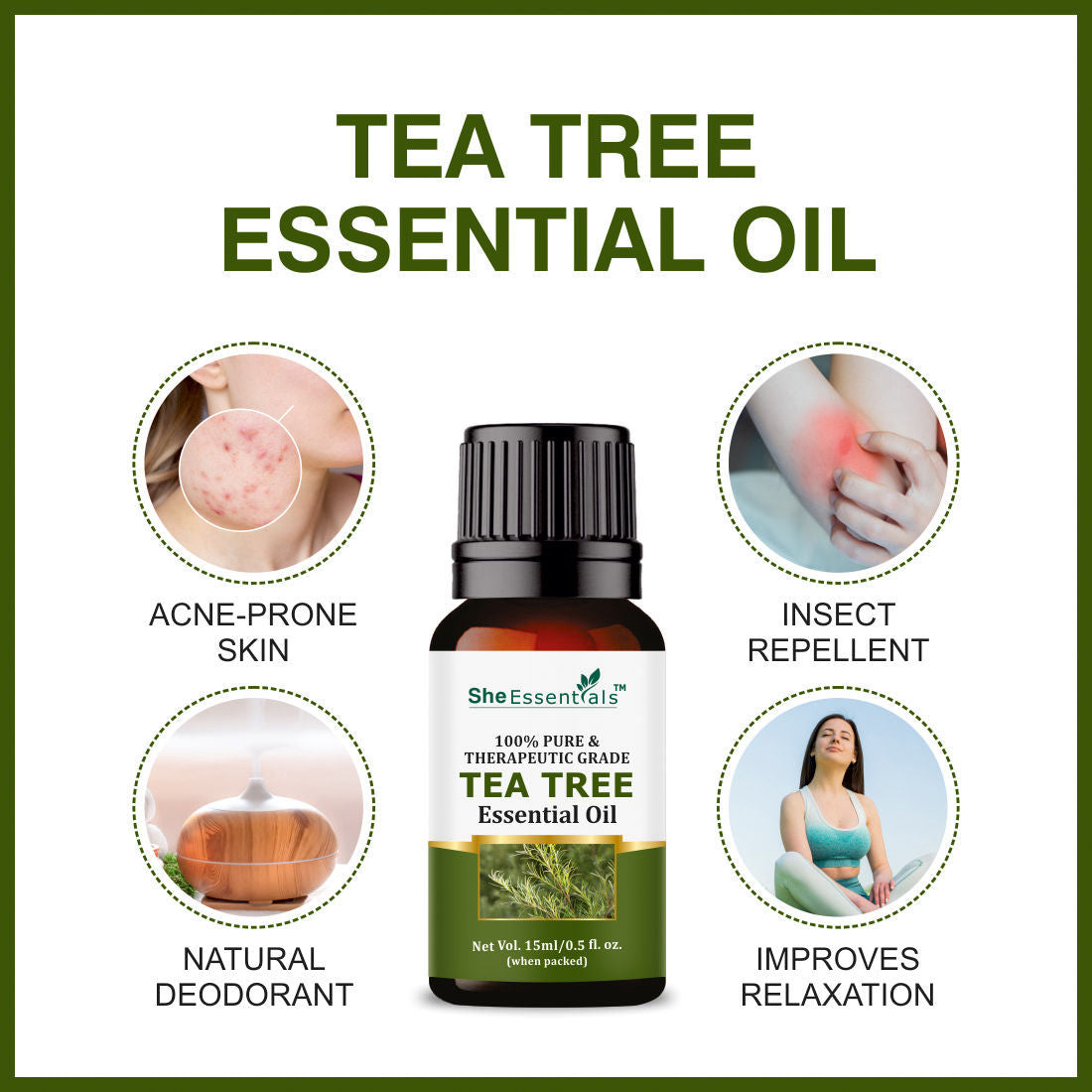Rosemary, Jojoba & Tea Tree Essential Oil For Hair Growth, Acne & Dandruff