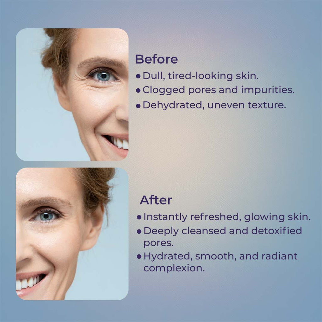 Ocean Dew Seaweed Face Sheet Mask, Hydrating & Glowing Korean Skincare Sheet Mask For Women