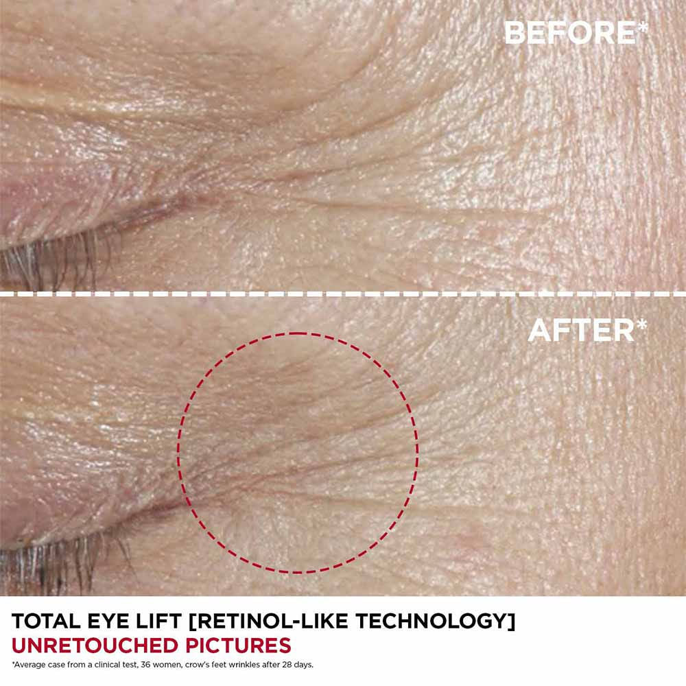 Total Eye Lift 15 ml