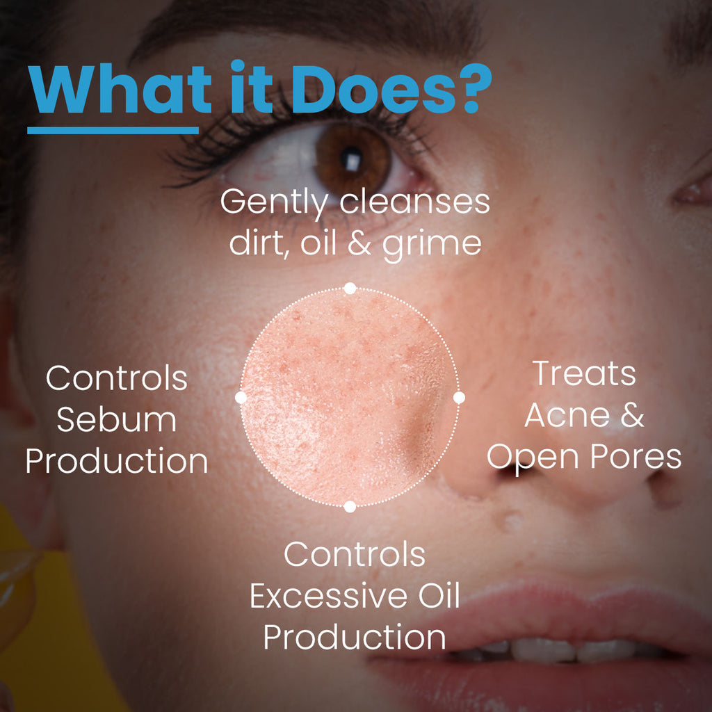 FCL Alpha Beta Acne Cleanser, Reduces Pimples, Sebum, Deep Pore Cleansing & NonComedogenic