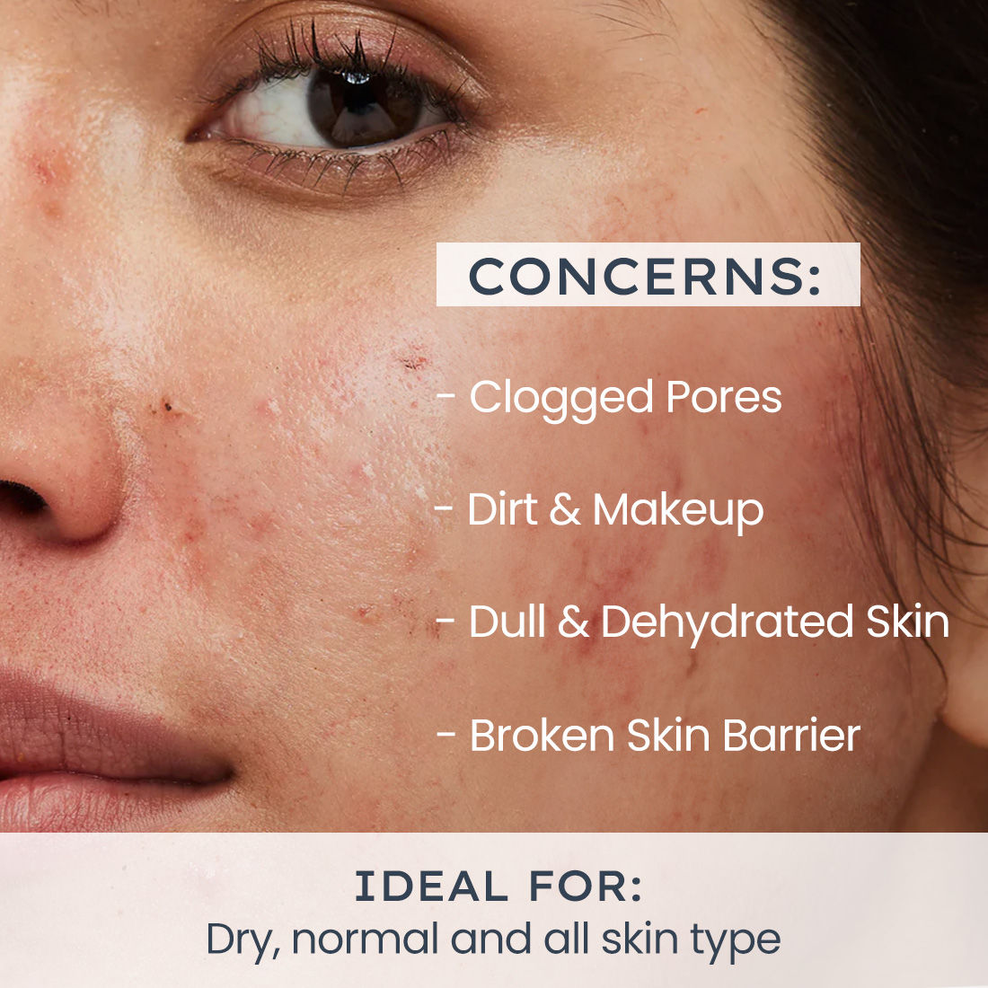 Moisturizing Cream for Dry Skin 2% Ceramides + Polyglutamic Acid Gentle Cleanser
