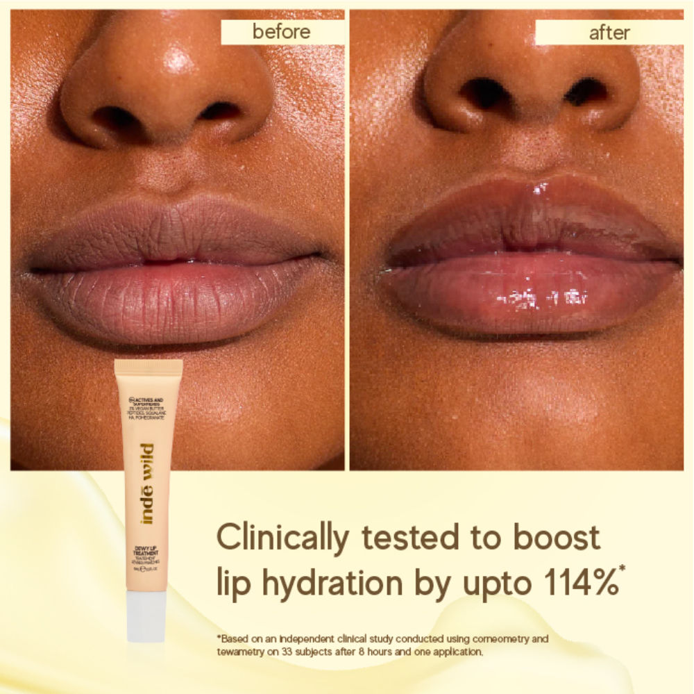 Dewy Lip Balms