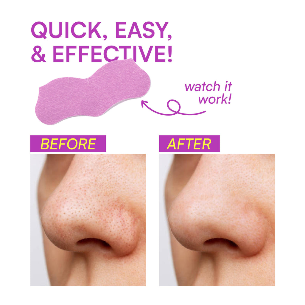 Nose Pore Patches - Lavender