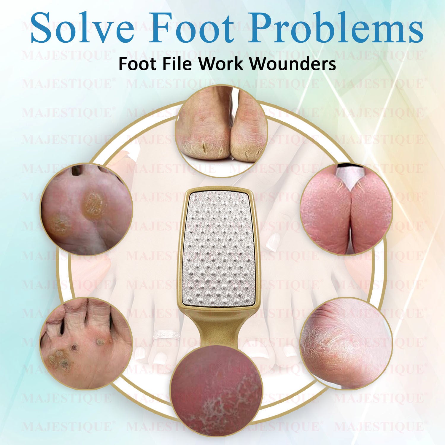 Professional Foot File - Laser-Cut Steel, Safe Dead Skin Remover - Color May Vary