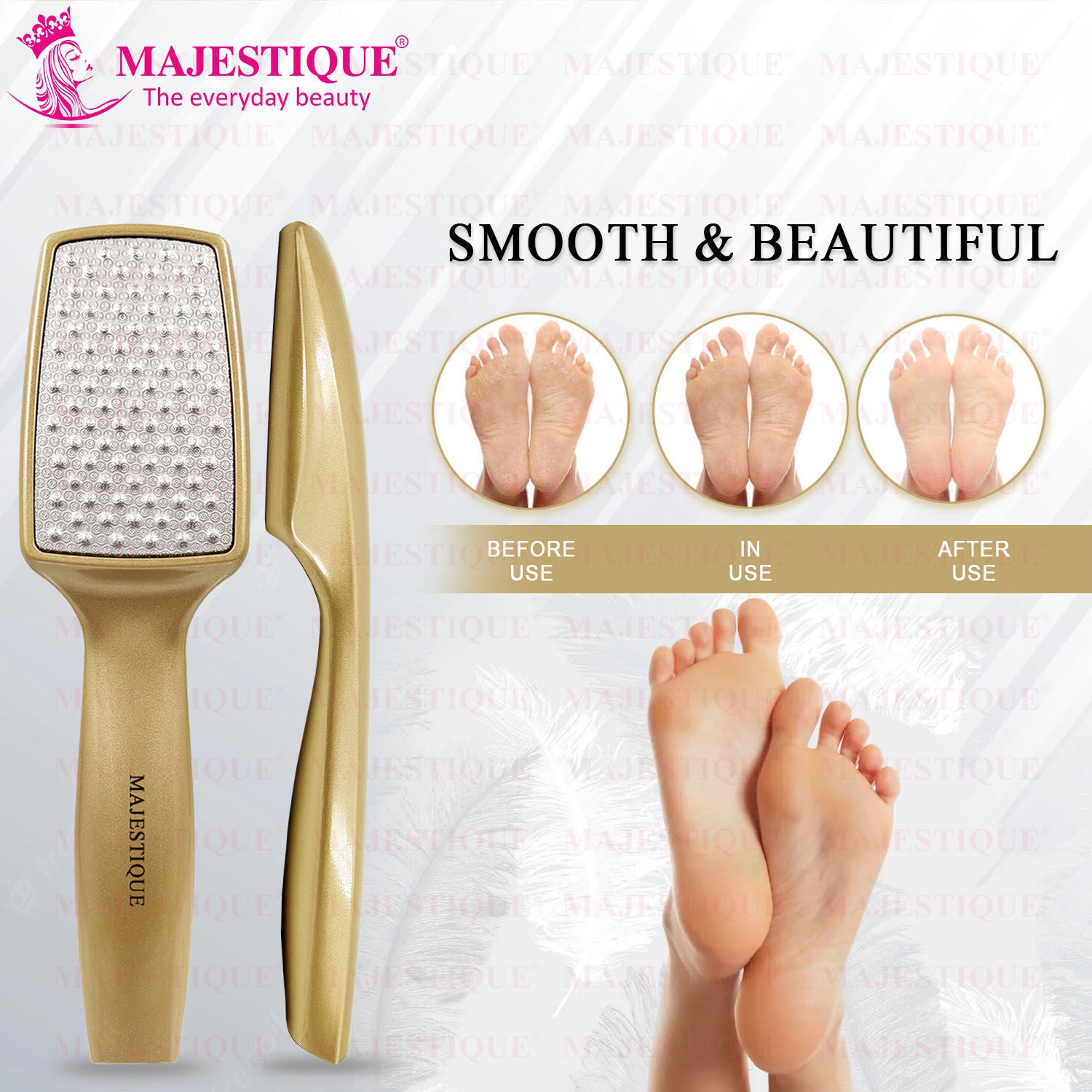 Professional Foot File - Laser-Cut Steel, Safe Dead Skin Remover - Color May Vary
