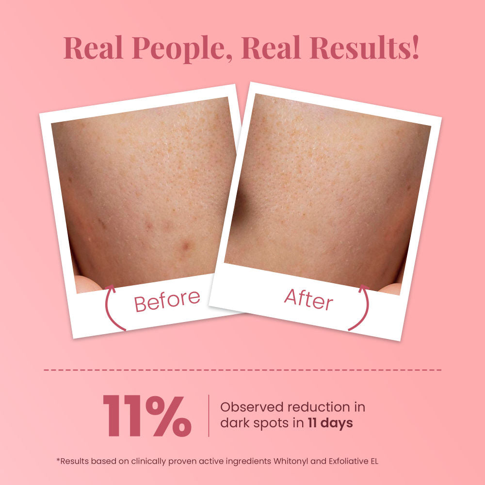 Ideal Bright Face Scrub For Flawless & Glowing Skin, Gentle Exfoliation, All Skin Types