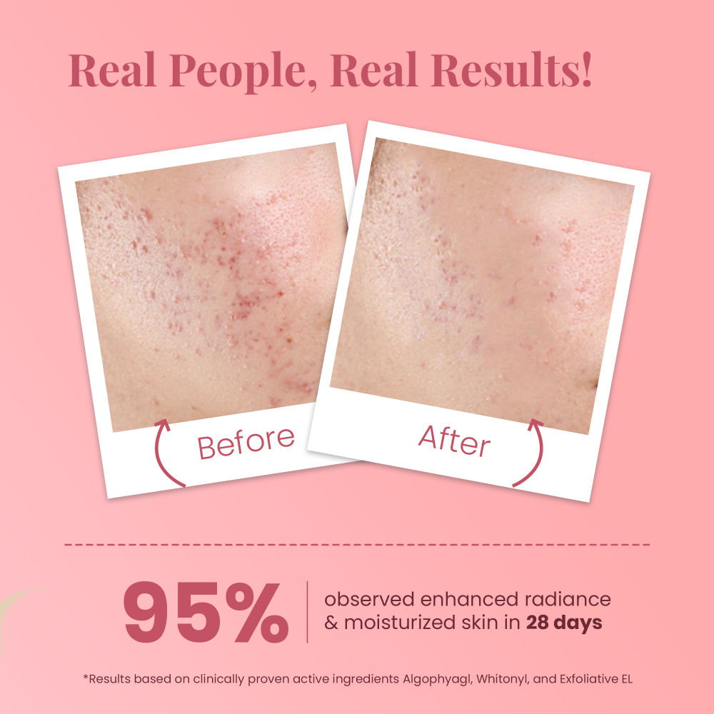 Ideal Bright Face Serum With Kakadu Plum For Hyperpigmentation & Dark Spot Reduction