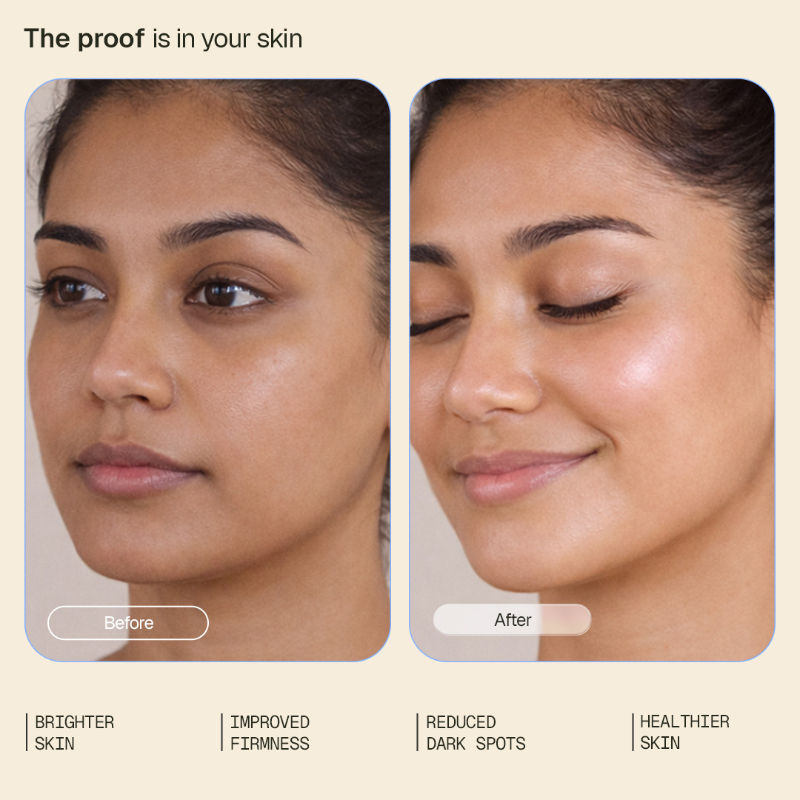 Vitamin C Face Serum|Brightens, Targets Pigmentation & Supports Collagen