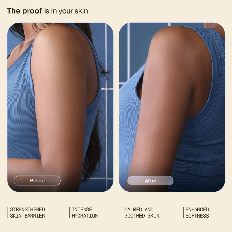 Ceramide Body Lotion, For Dry, Damaged Skin, Deep Nourishment & Barrier Repair