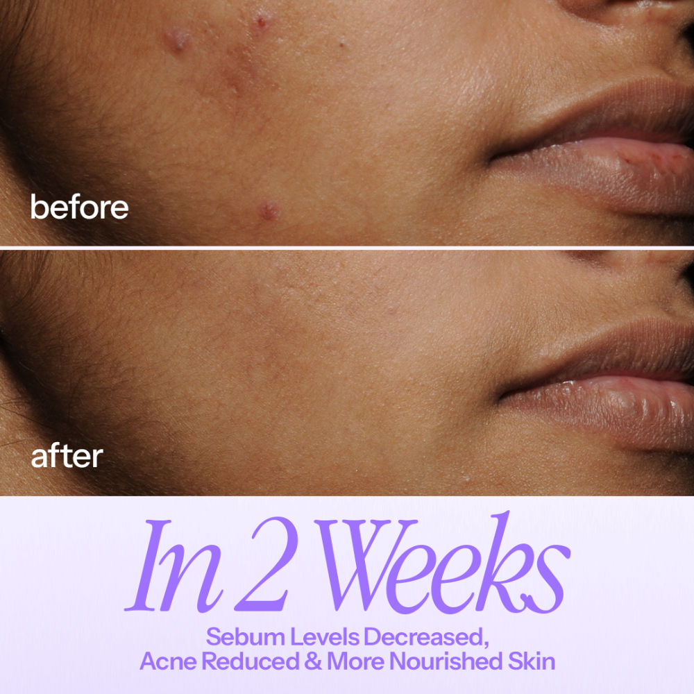 Inbalance Soothing Milky Toner