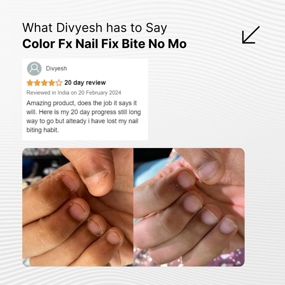 Nail Fix Bite No-More - 204