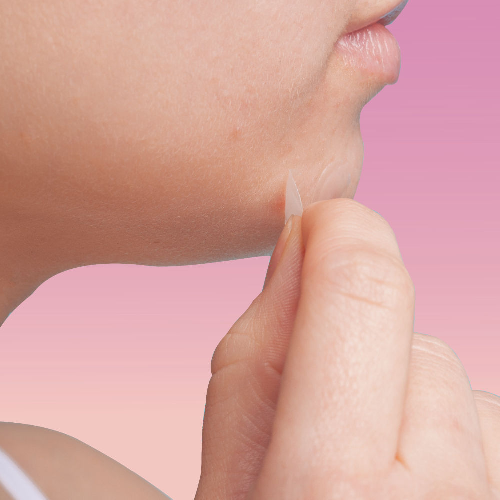 Pimple Patch With Hydrocolloid & Salicylic Acid For Acne Healing & Spot Correction