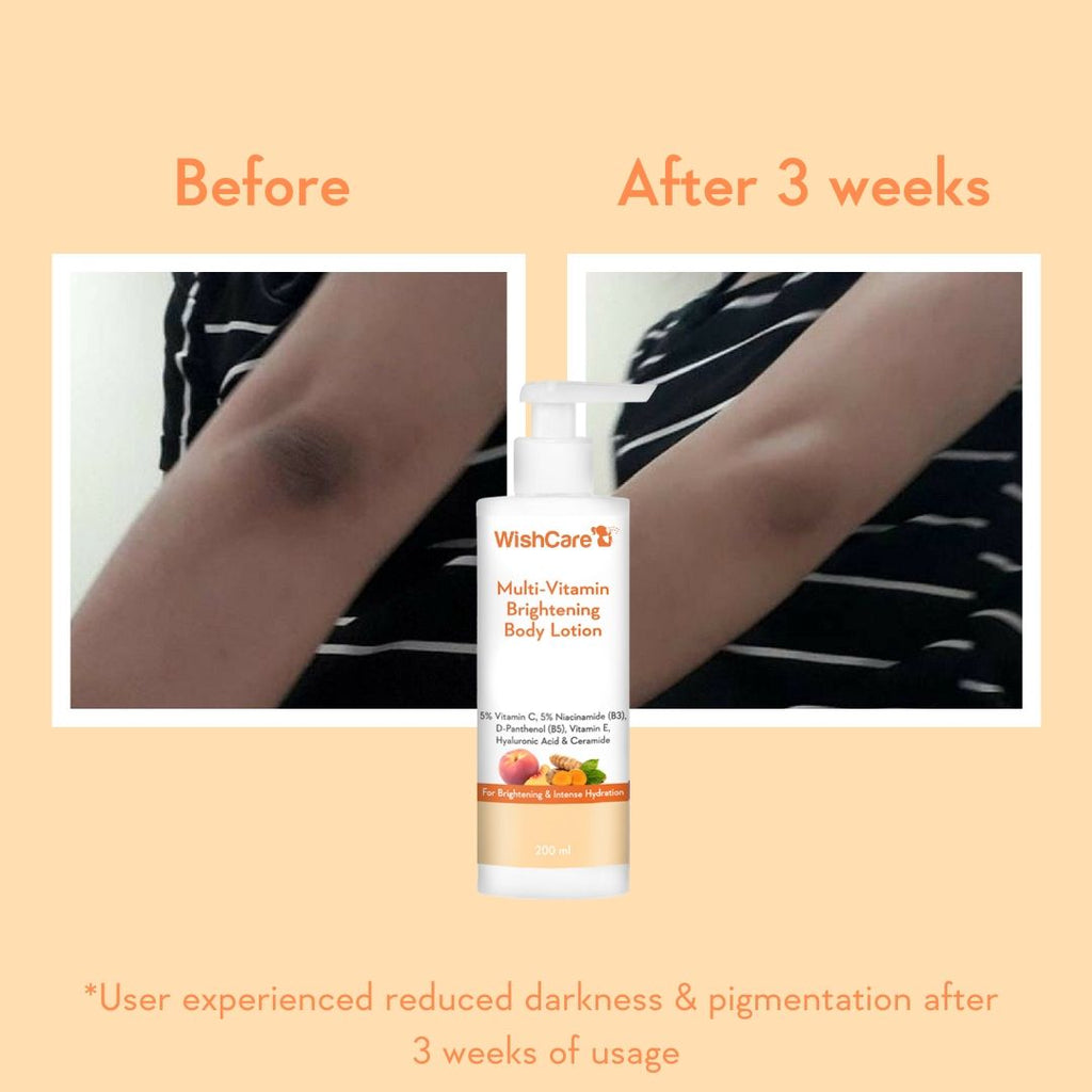Multi-Vitamin Brightening Body Lotion for Glowing Skin-Reduces Pigmentation & Dark Spots