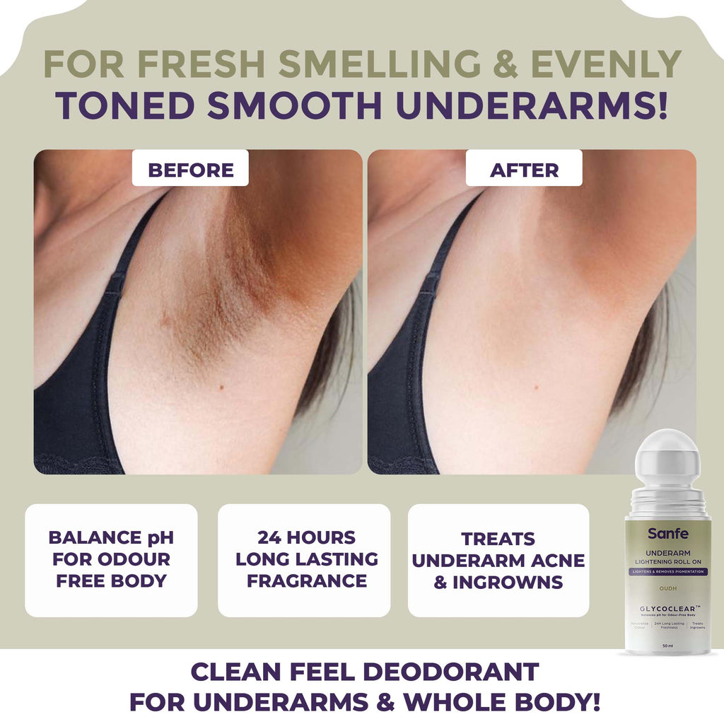Underarm Lightening Roll On (Oudh) with 5% AHA