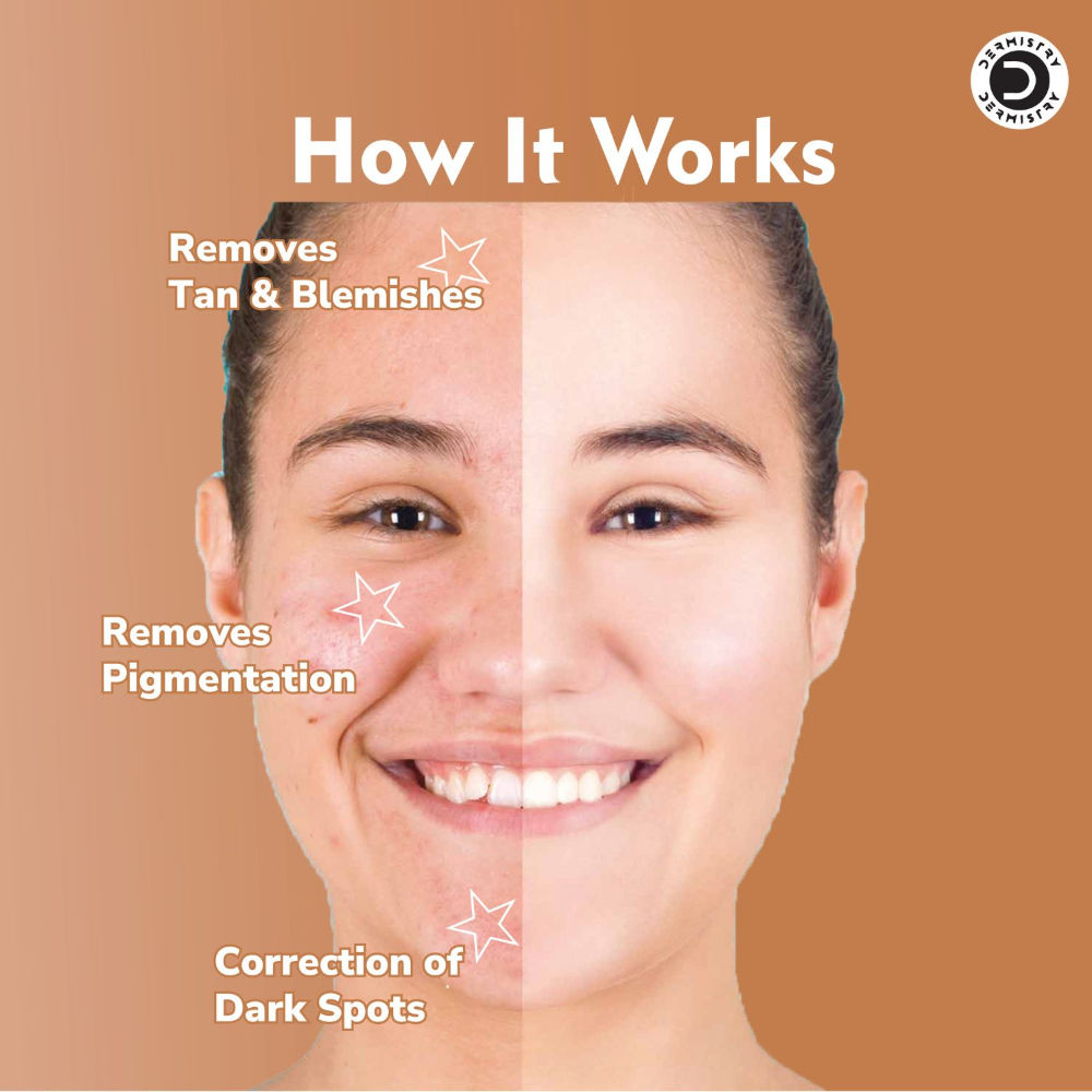 Kojic Acid Face Cream Pigmentation Tan Removal Glowing Skin Whitening Lightening Fairness