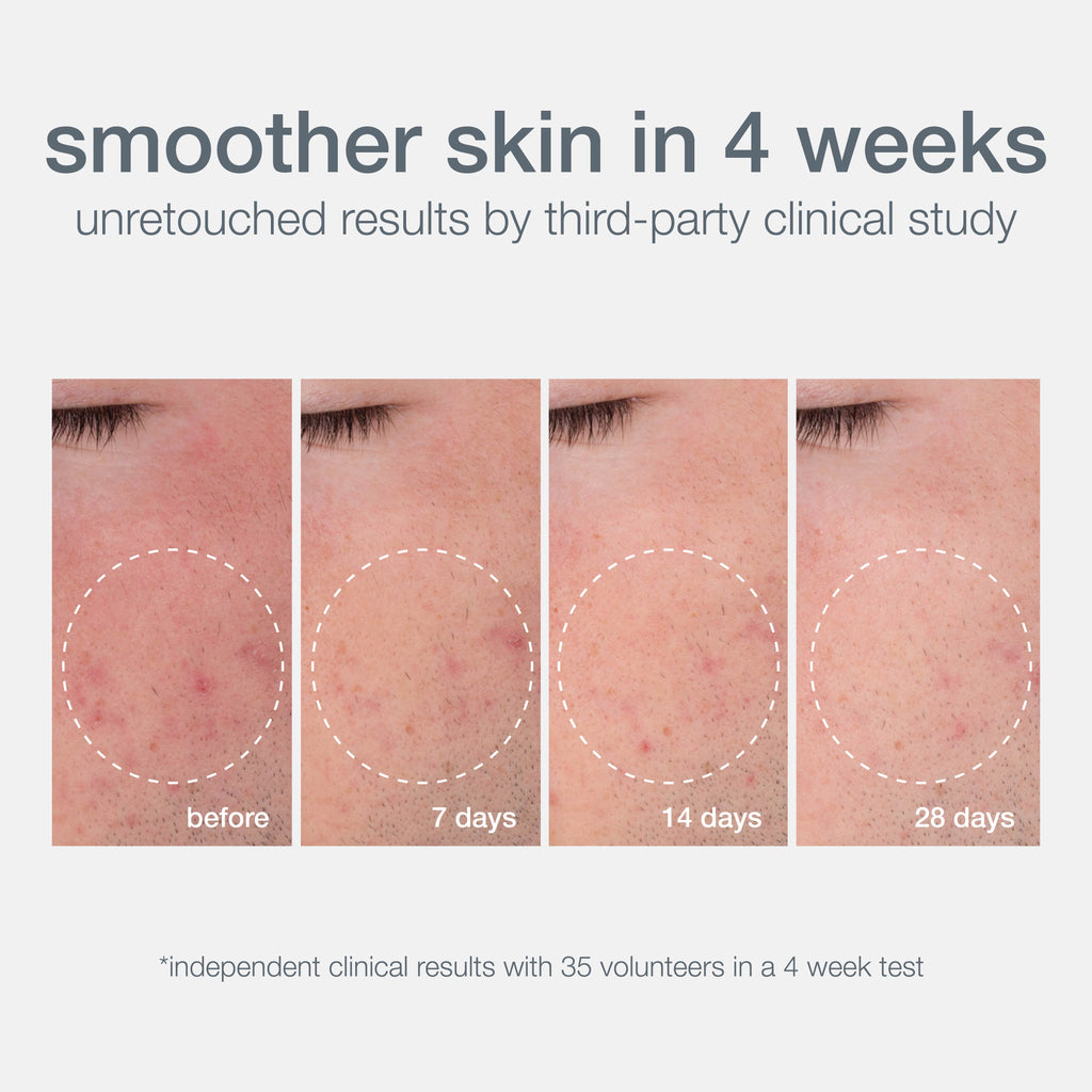 Daily Microfoliant Face Scrub