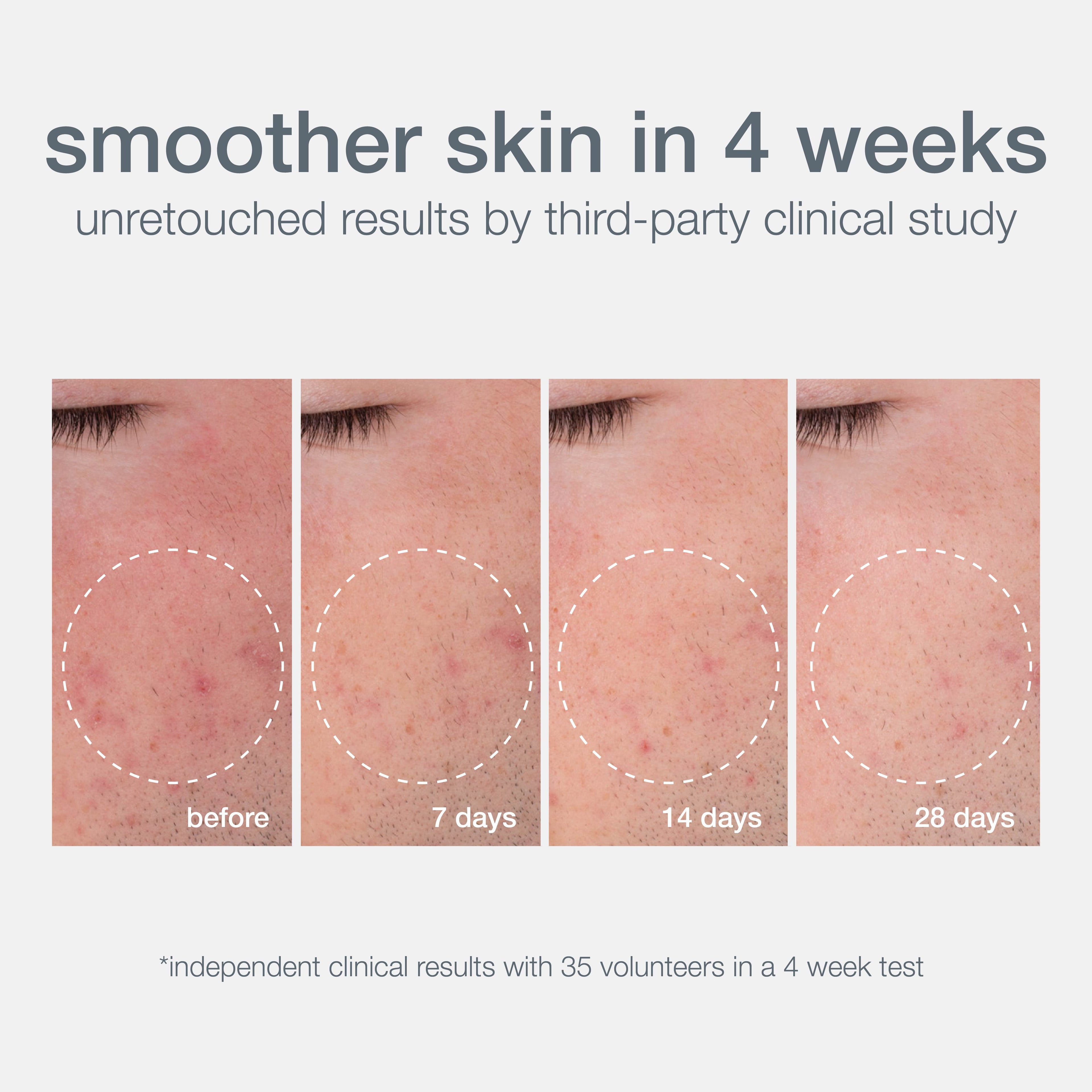 Daily Microfoliant Face Scrub