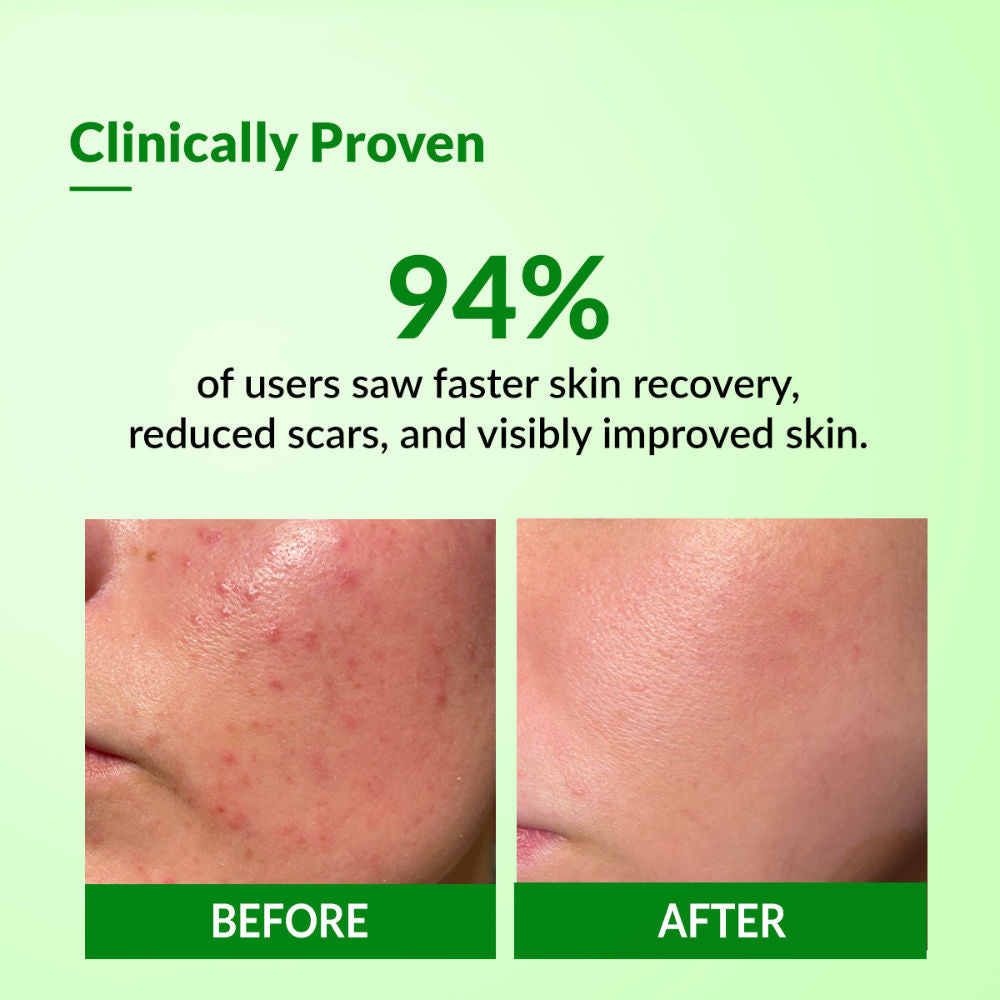 Cleovera Cica Cream for Skin Moisturizer