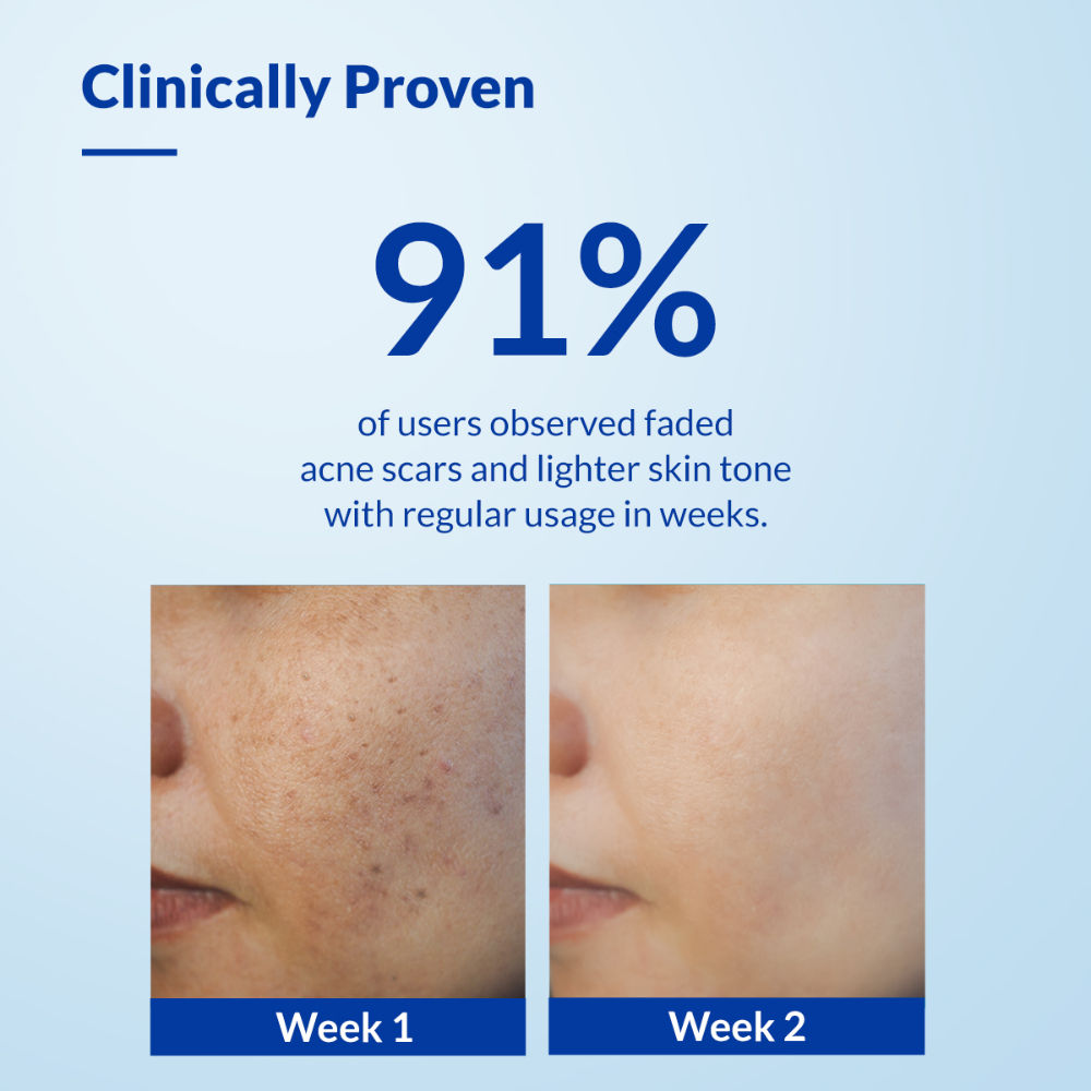 Skarfix-TX Kojic Acid Face Wash for Pigmentation Control with Tranexamic Acid