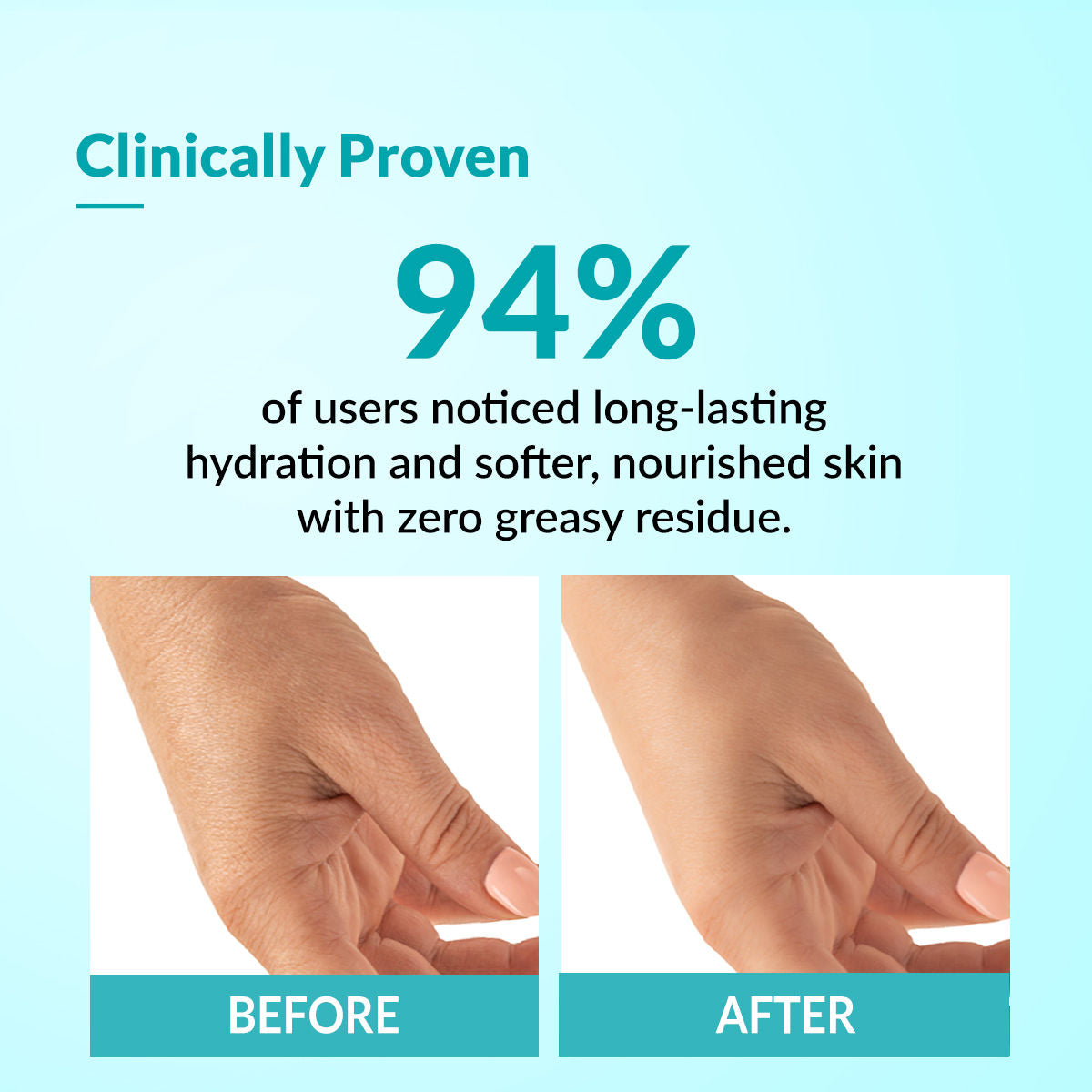 Moisturizing Lotion Ideal For All Skin Types