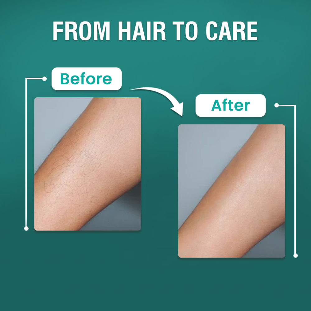 Hair Removal Cream Easy & Gentle Hair Removal Solution