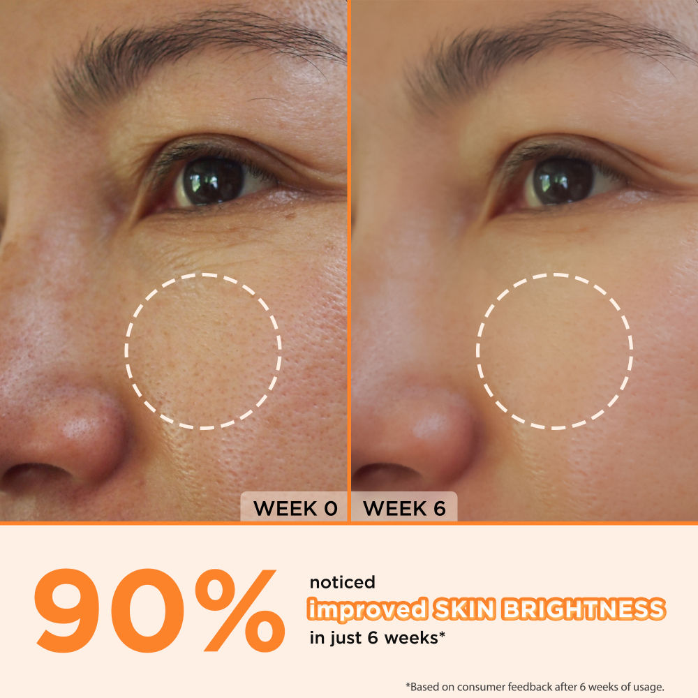 30% Vitamin C Face Serum With Hyaluronic Acid – Skin Glowing & Brightening Serum