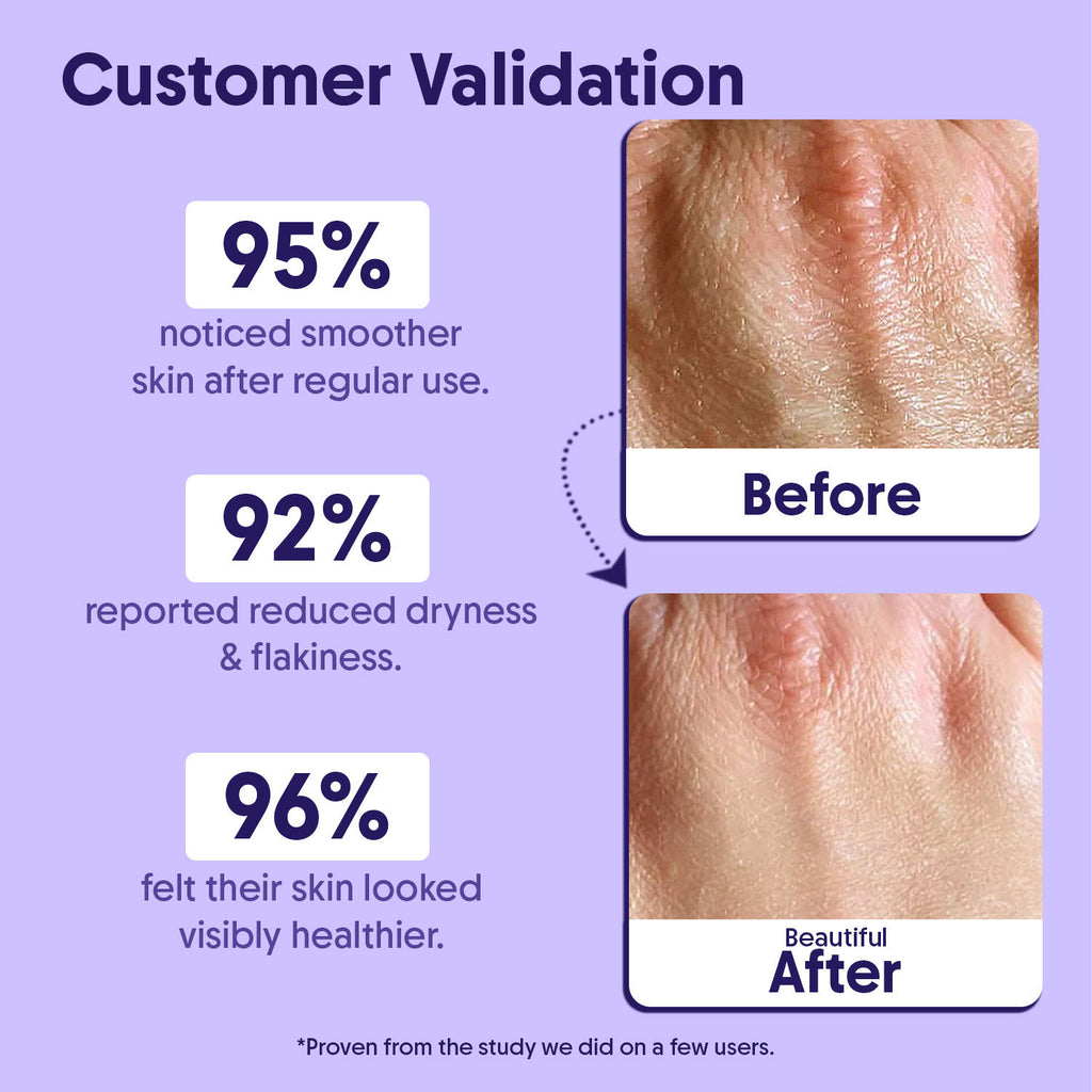 10% AHA + 1% BHA Body Lotion, Brightening, Tan Removal & Strawberry Skin For Dry Skin