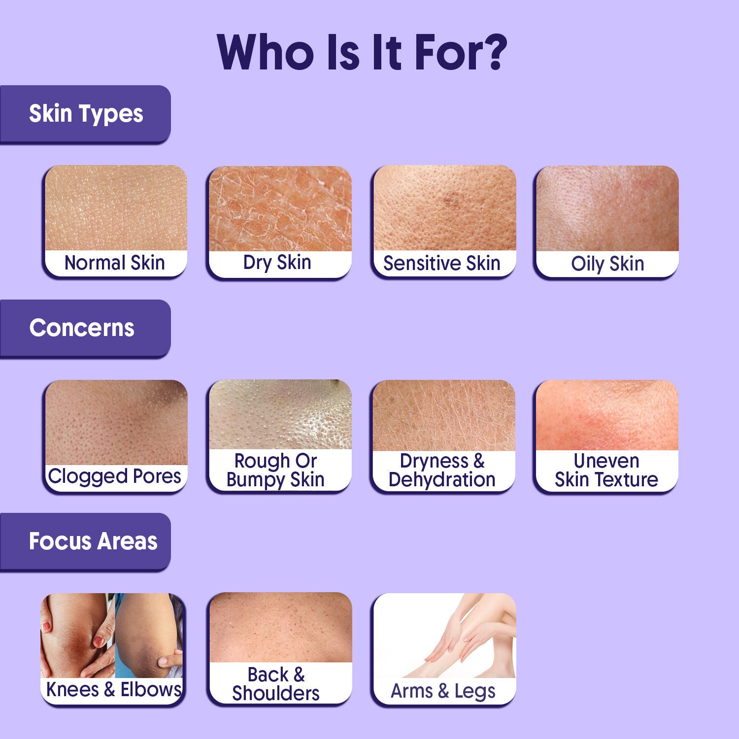 10% AHA + 1% BHA Body Lotion, Brightening, Tan Removal & Strawberry Skin For Dry Skin