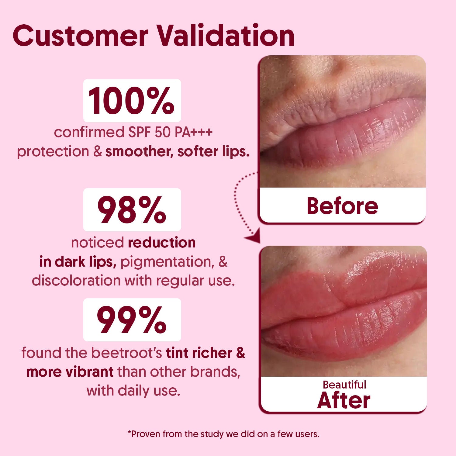 Beetroot Tinted Lip Balm SPF 50 PA++++,Dry & Dark Pigmented Lips,Kojic Acid & Ceramide