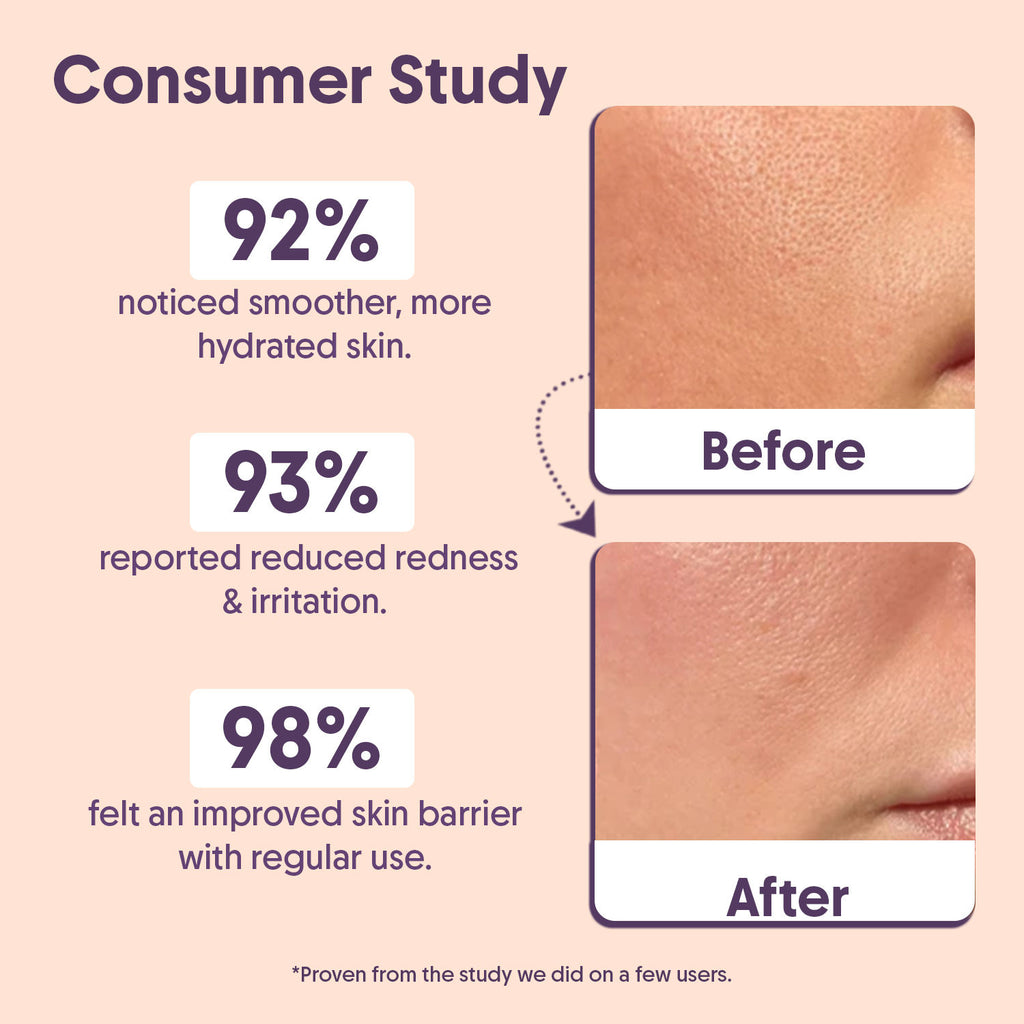 Barrier Repair Face Moisturiser, Ceramide & Niacinamide, Dry, Oily & Sensitive Skin