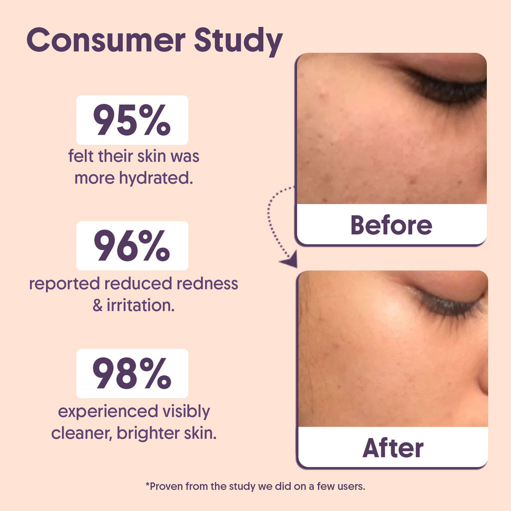 Barrier Repair Cleanser, Ceramide & Niacinamide, For Oily, Dry & Acne Prone Skin