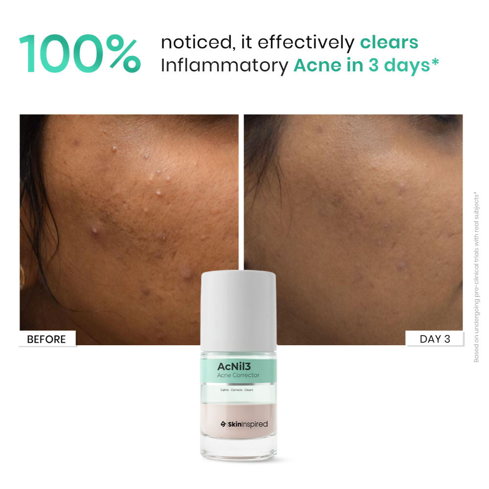 Acnil3 Rapid Spot Corrector