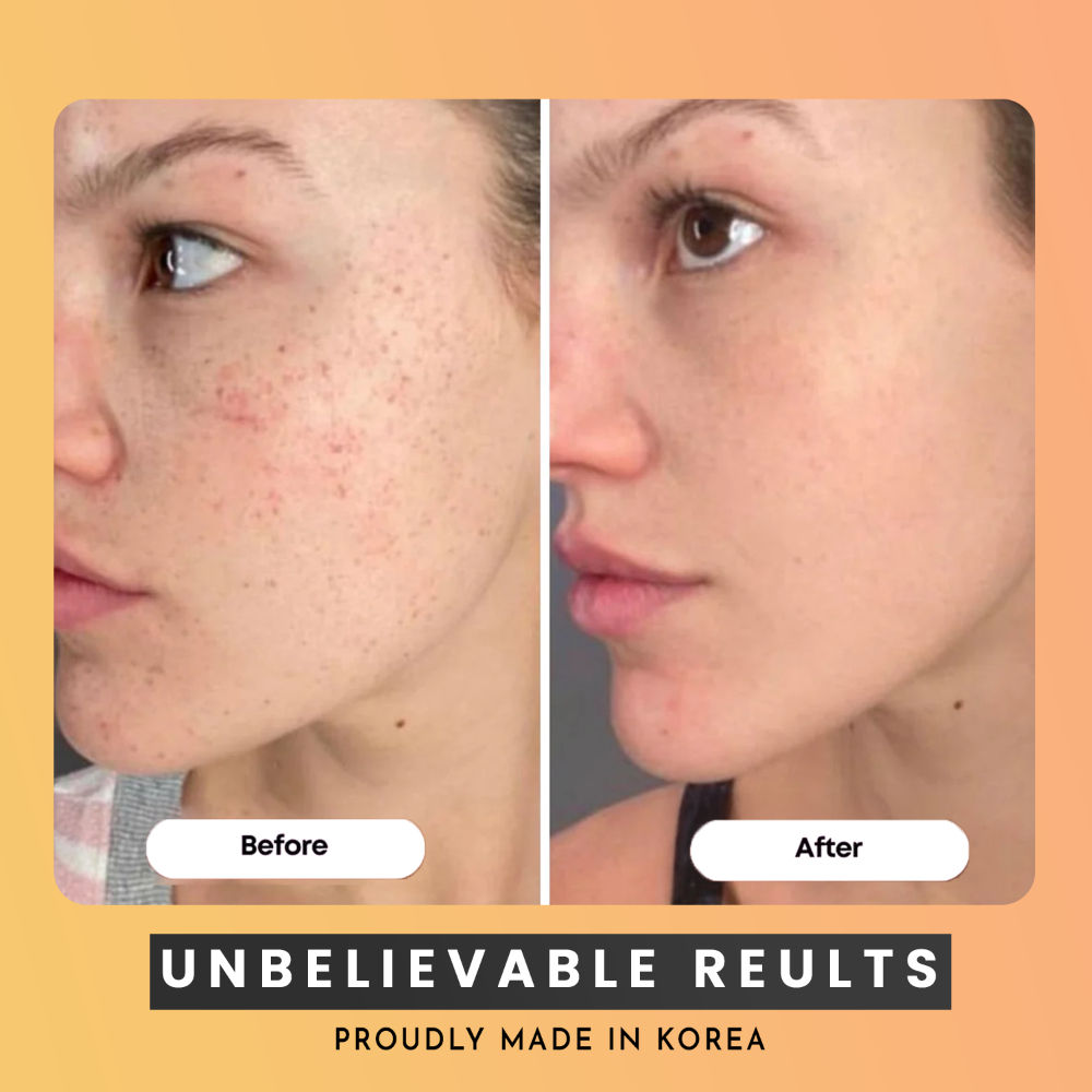 Turmeric & Kojic Acid Face Cleansing Pads