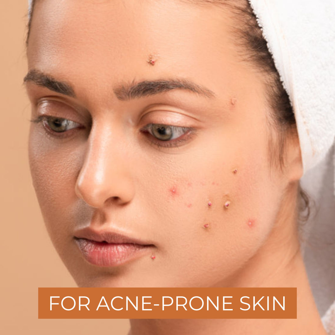 Almond Aloe Vera Gel for Face & Body Skin Treatment