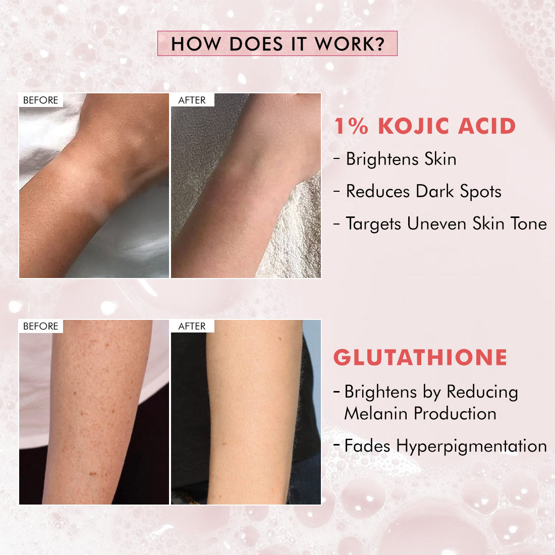 Brightening Tan Removal Soap - 1% Kojic Acid & Glutathione -Tangy Guava Perfume Syndet Bar