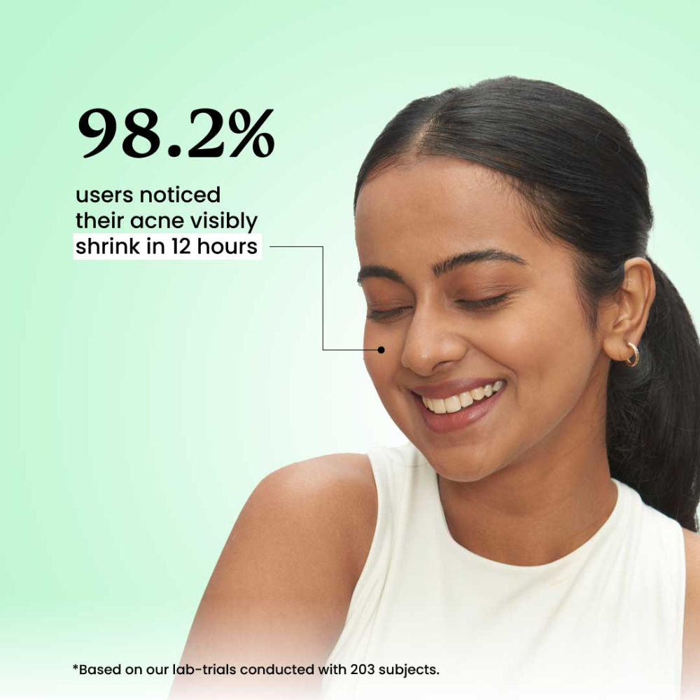 Acne Spot Corrector Gel with Azelaic Acid + AHA + BHA for Treating Active Acne in 12 hrs