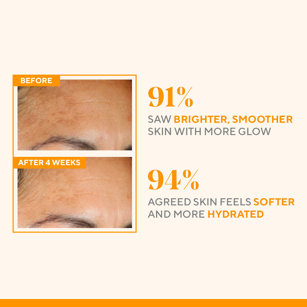Vita - C Glycolic Serum