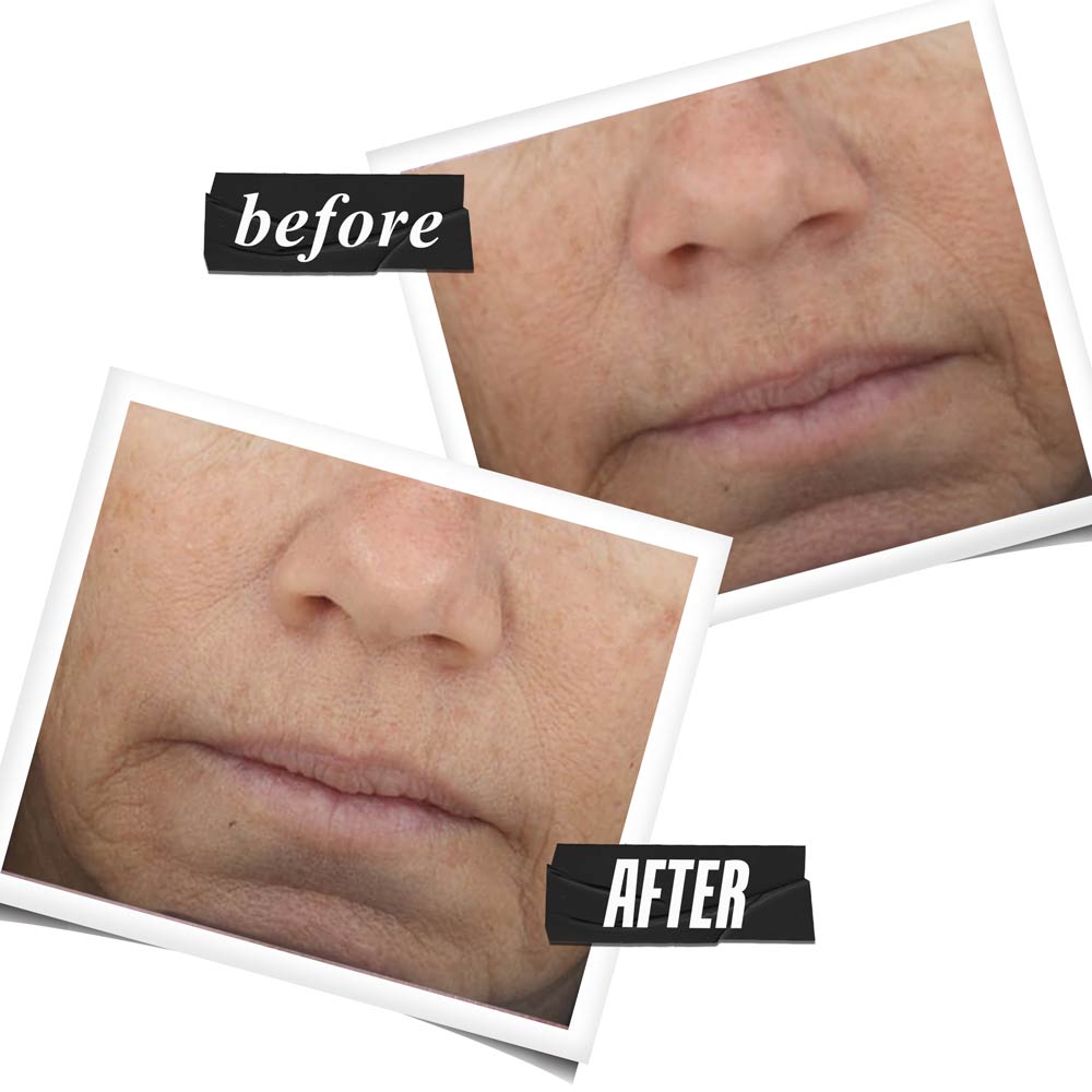Powerful-Strength Line-Reducing Concentrate With Vitamin C & Hyaluronic Acid