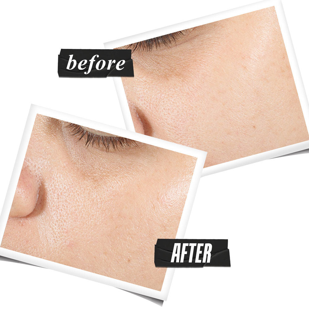 Ultra Pure High-Potency Serum with 1.5% Hyaluronic Acid