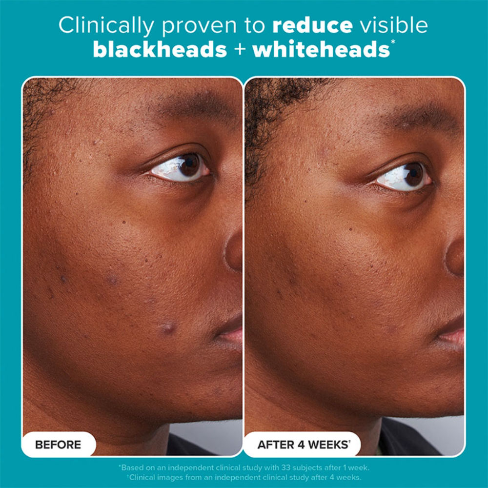 Skin Perfecting 2% Bha Liquid Exfoliant