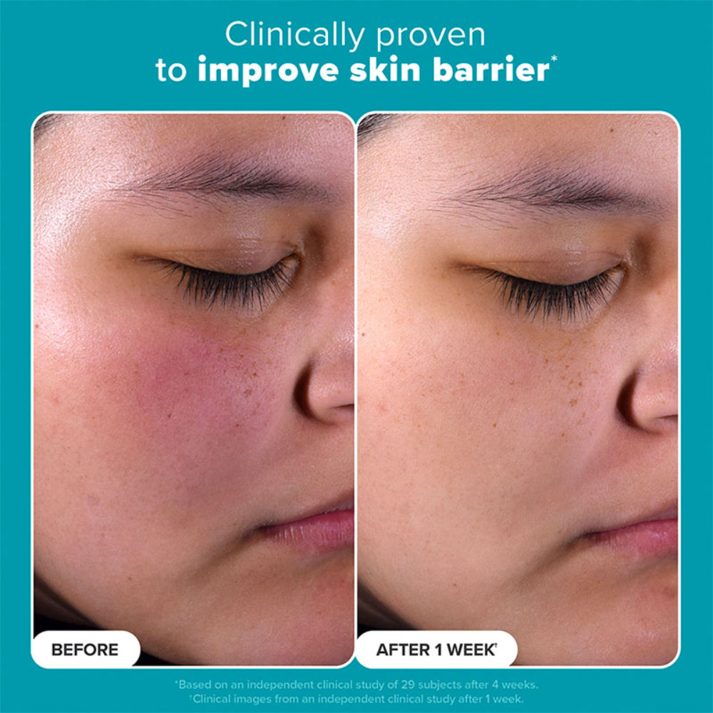 Skin Perfecting 2% Bha Liquid Exfoliant
