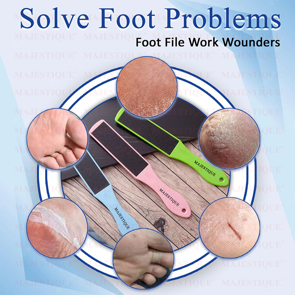 Double-Sided Foot File for Callus Removal, Smooth Feet - Color May Vary