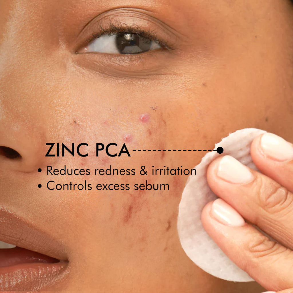 2% Salicylic Acid & Zinc Anti-Acne Pads For Clear Skin Serum Pads With Matcha Tea